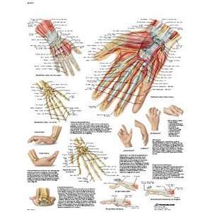   Wrist Anatomy and Pathology Chart, Spanish), Poster Size 20 Width x