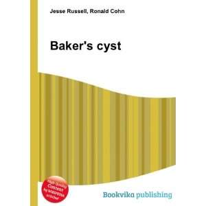  Bakers cyst Ronald Cohn Jesse Russell Books