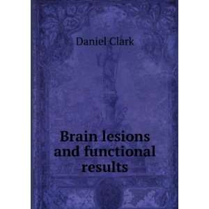  Brain lesions and functional results. 1: Daniel Clark 